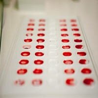 Blood Group Typing Market Analysis 2019 | Bio-Rad Laboratories, Inc., Bag Health Care GmbH