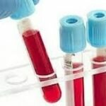 Hematocrit Test Market